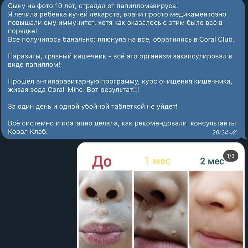 Антипаразитарная программа для детей Корал Клаб. Инструкция. Отзывы